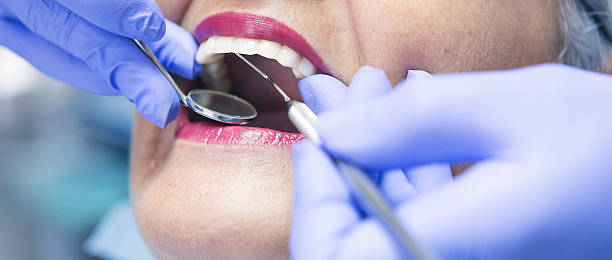 Best Emergency Dental Extractions in Galena, OH